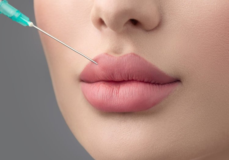 Non-Surgical Lip Enhancement: Russian Lip Fillers Treatment in Dubai