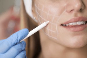 Get Natural-Looking Results with the Best Fillers in Dubai