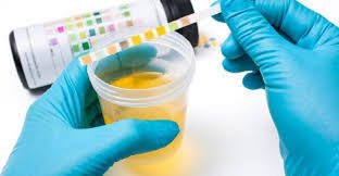 Drug Abuse Testing Market Trends Forecast Report 2025-2033