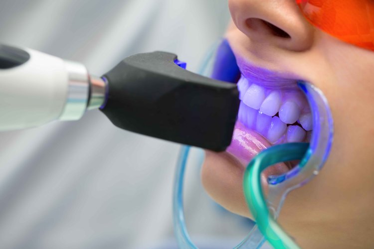 Gum Health Is Important: Insights from Local Dental Hygienists