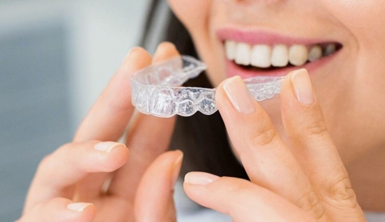 Invisalign Dubai: How Long Does the Treatment Take and What to Expect