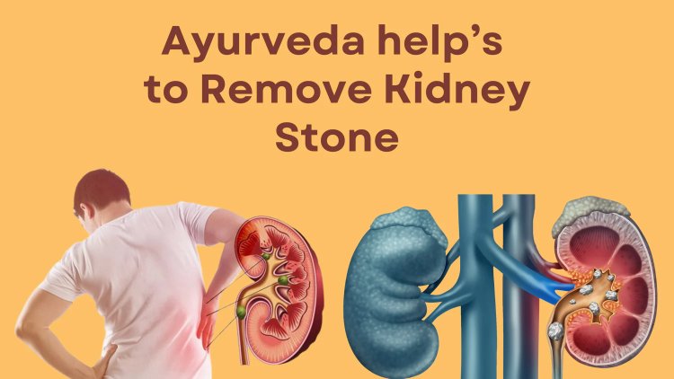 Kidney Stone Ayurvedic Solutions: SL-90 Renal Drop & Stone Removal Capsule
