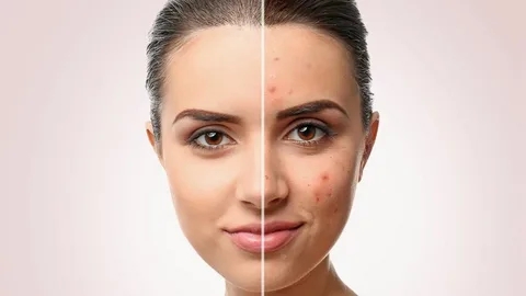 Discover the Benefits of Ultraclear Laser Treatments Near You