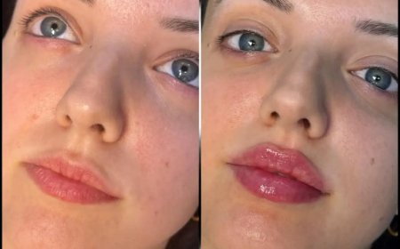 Best Aesthetic Clinics in dubai for Fillers: Non-Invasive Alternatives to Surgery