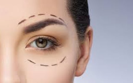 Upper Blepharoplasty in Jeddah: Revitalize Tired Eyes with Precision Eyelid Surgery