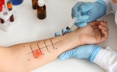 How Much Does Allergy Testing Cost in Dallas? A Complete Price & Services Breakdown