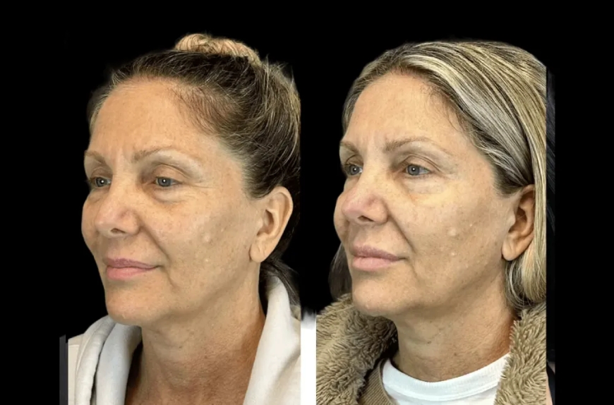 How the Best Aesthetic Clinic in Dubai Combines Technology and Tradition