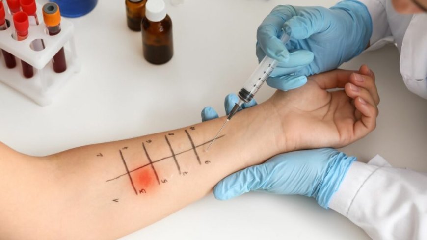 How Much Does Allergy Testing Cost in Dallas? A Complete Price & Services Breakdown