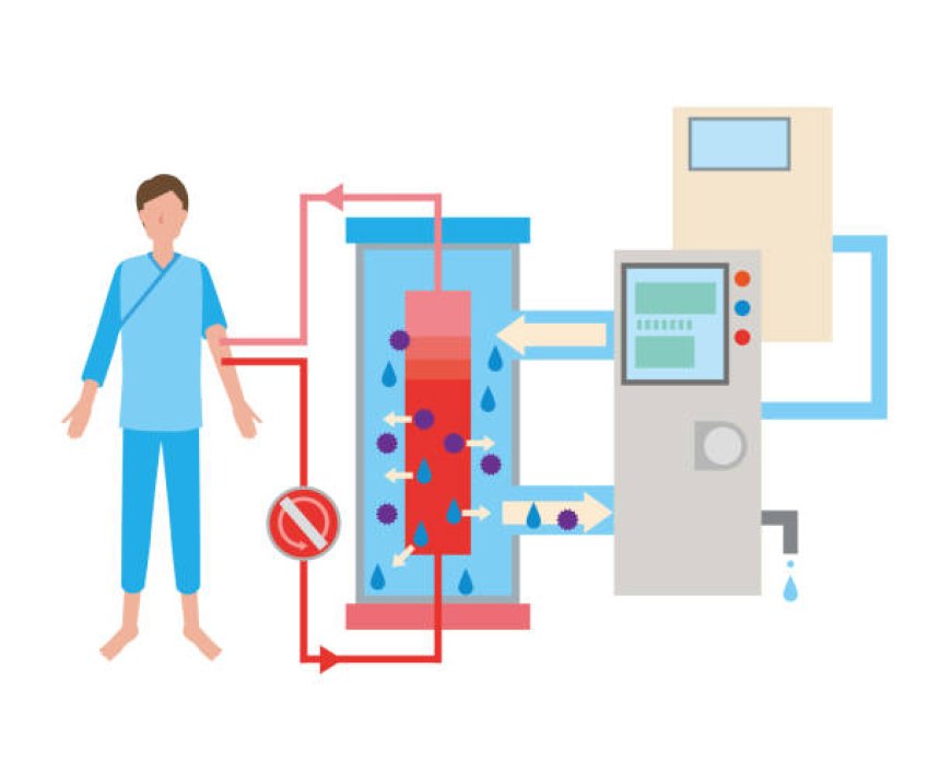 Setting Up Home Hemodialysis: A Beginner’s Guide
