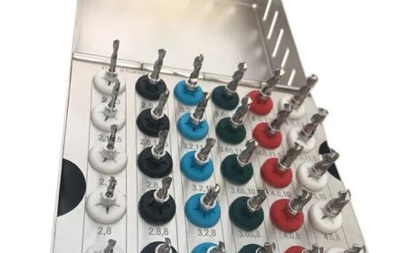 Top 5 Dental Implant Supplies Every Practice Should Stock