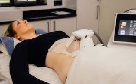 Fat Removal Treatment Islamabad: The New Trend in Body Contouring