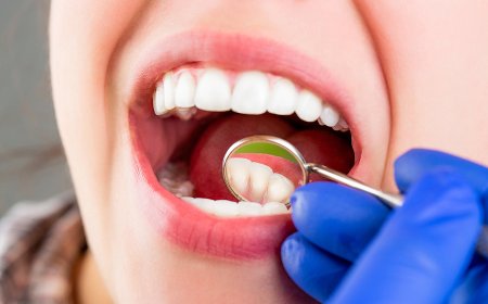 Comprehensive Dentistry in Houston | Complete Dental Care Guide