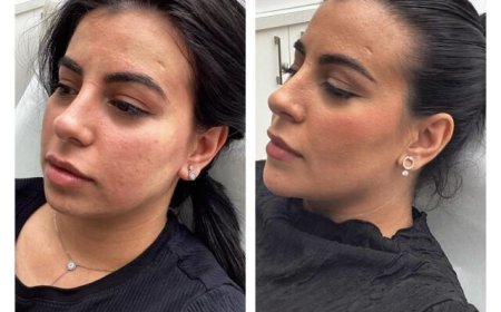 Discover Your Best Skin A Guide to Richmond's Premier Skin Clinics