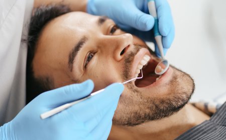 Brighten Your Smile: A Complete Guide to Teeth Cleaning in Dubai