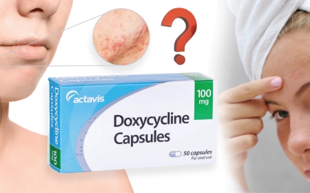 Doxycycline 100 mg for Acne, Infections, and More: What You Should Know