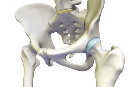 Hip Pain? Here’s How the Best Hip Replacement Surgeon in Jaipur Can Help