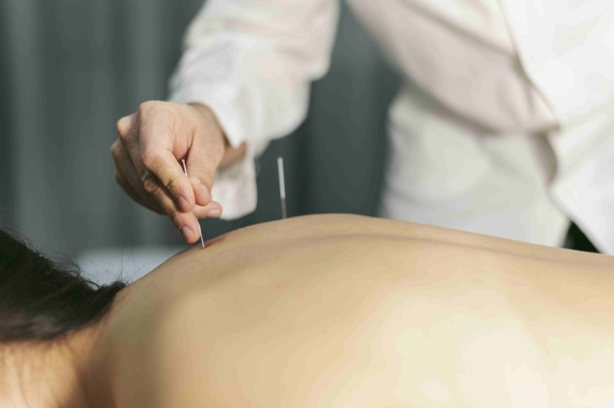 Acupuncture for Hormonal Balance: Regain Control of Your Health