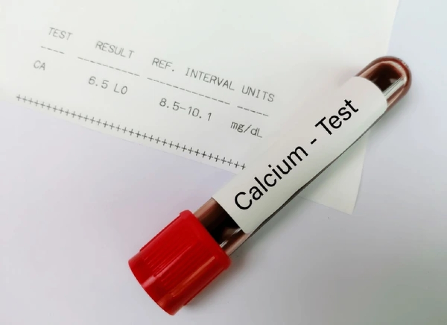 Calcium Test Price: Know the Cost and Importance of This Essential Health Test