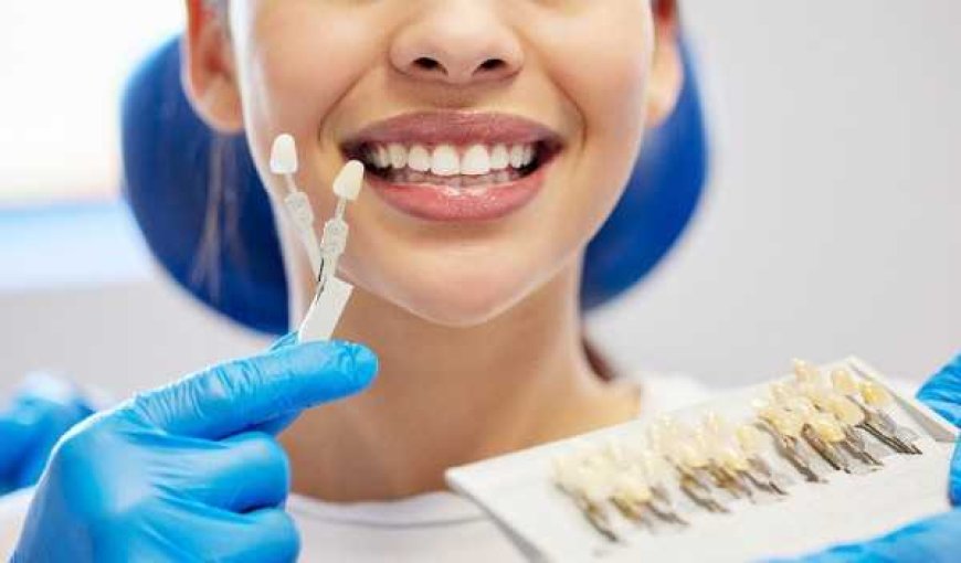 The Art of Choosing Teeth Whitening Shades for Your Best Smile