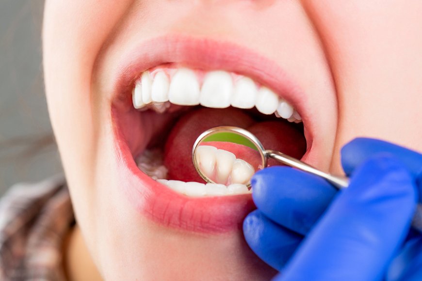 Comprehensive Dentistry in Houston | Complete Dental Care Guide