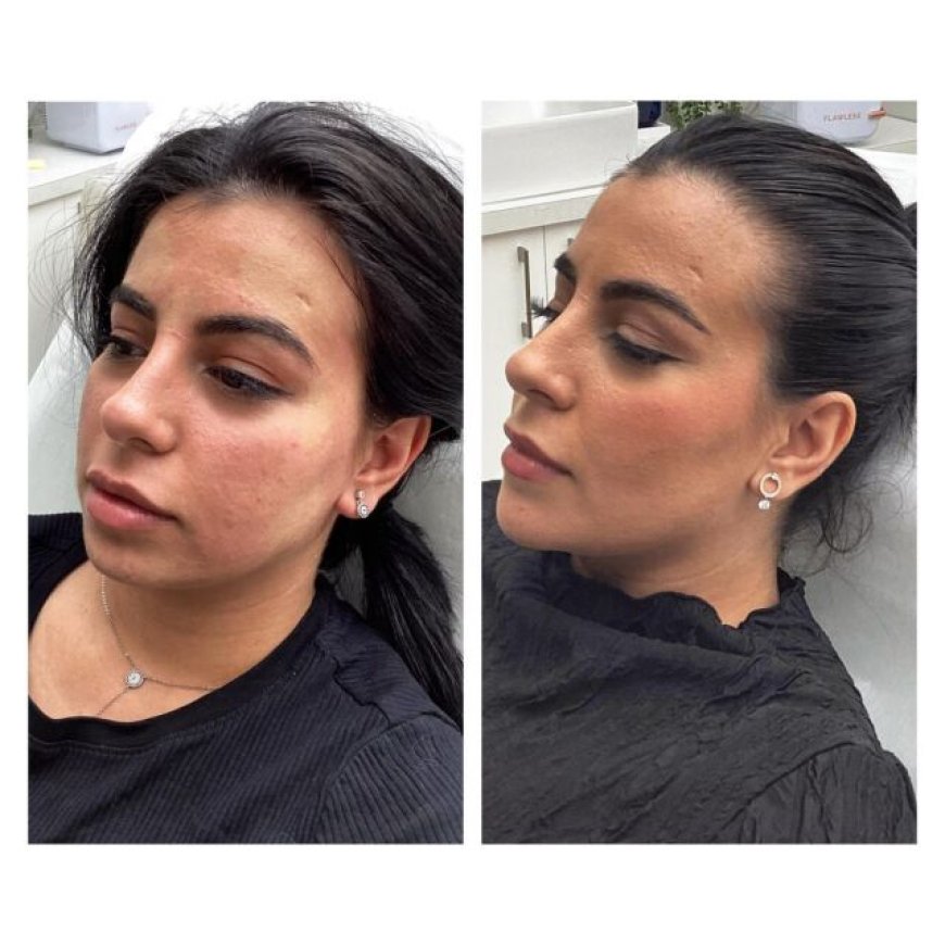 Discover Your Best Skin A Guide to Richmond's Premier Skin Clinics