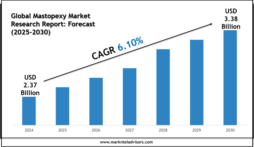 Global Mastopexy Industry Growth to 2030: Market Insights from Cynosure and GC Aesthetics