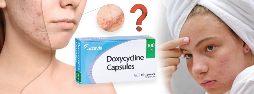 Doxycycline 100 mg for Acne, Infections, and More: What You Should Know