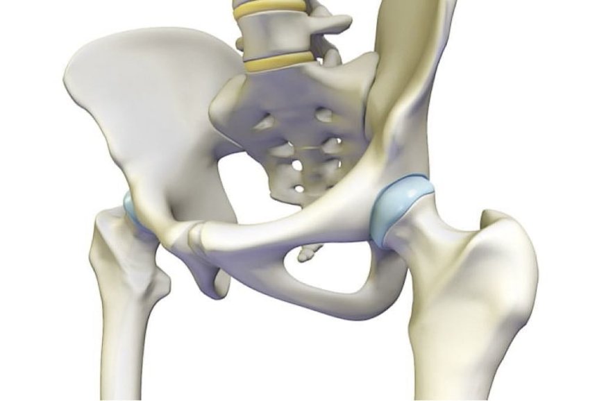 Hip Pain? Here’s How the Best Hip Replacement Surgeon in Jaipur Can Help