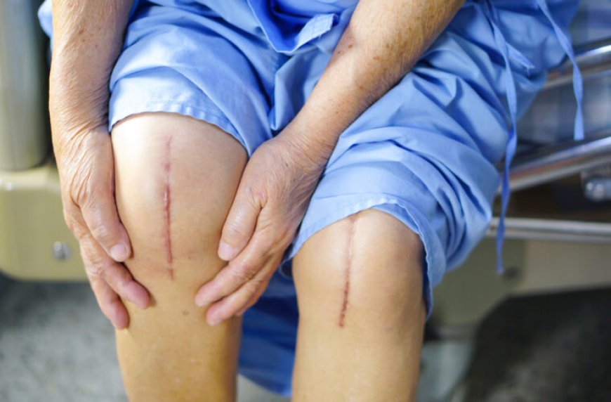 Is Joint Replacement Surgery Safe for Senior Citizens?